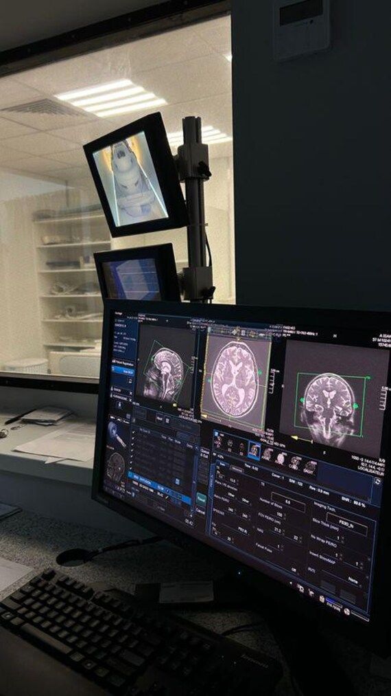 Radiography Positioning Flashcards
